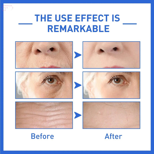 Anti-Aging Collagen Serum with Nicotinamide eprolo