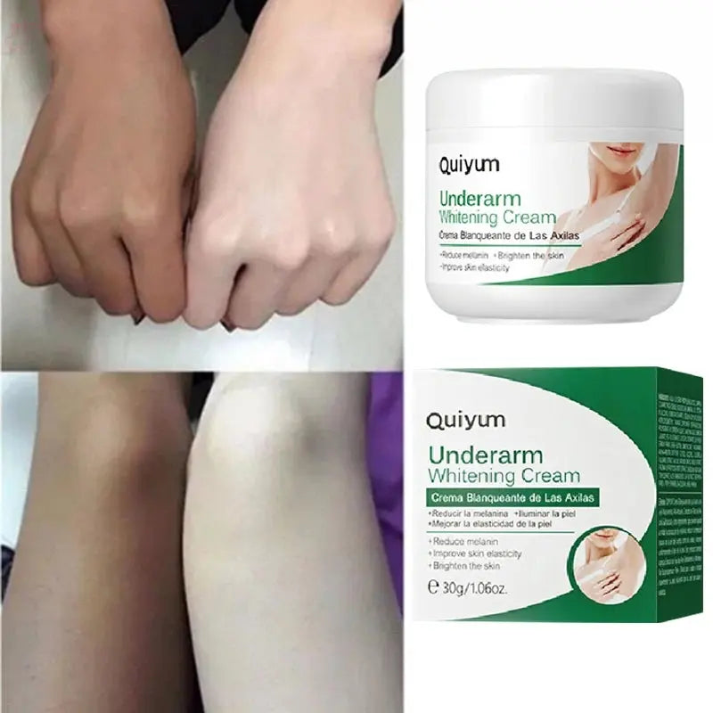 Effective Improve Body Whitening Cream Armpit Legs Knee Elbow Bleaching Cream Dull Remove Dark Spots Melanin Brighten Skin Care - Brocelles