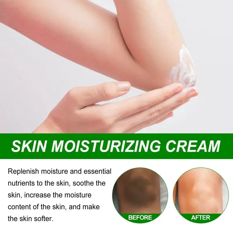 Effective Improve Body Whitening Cream l Remove Dark Spots Melanin Brocelles