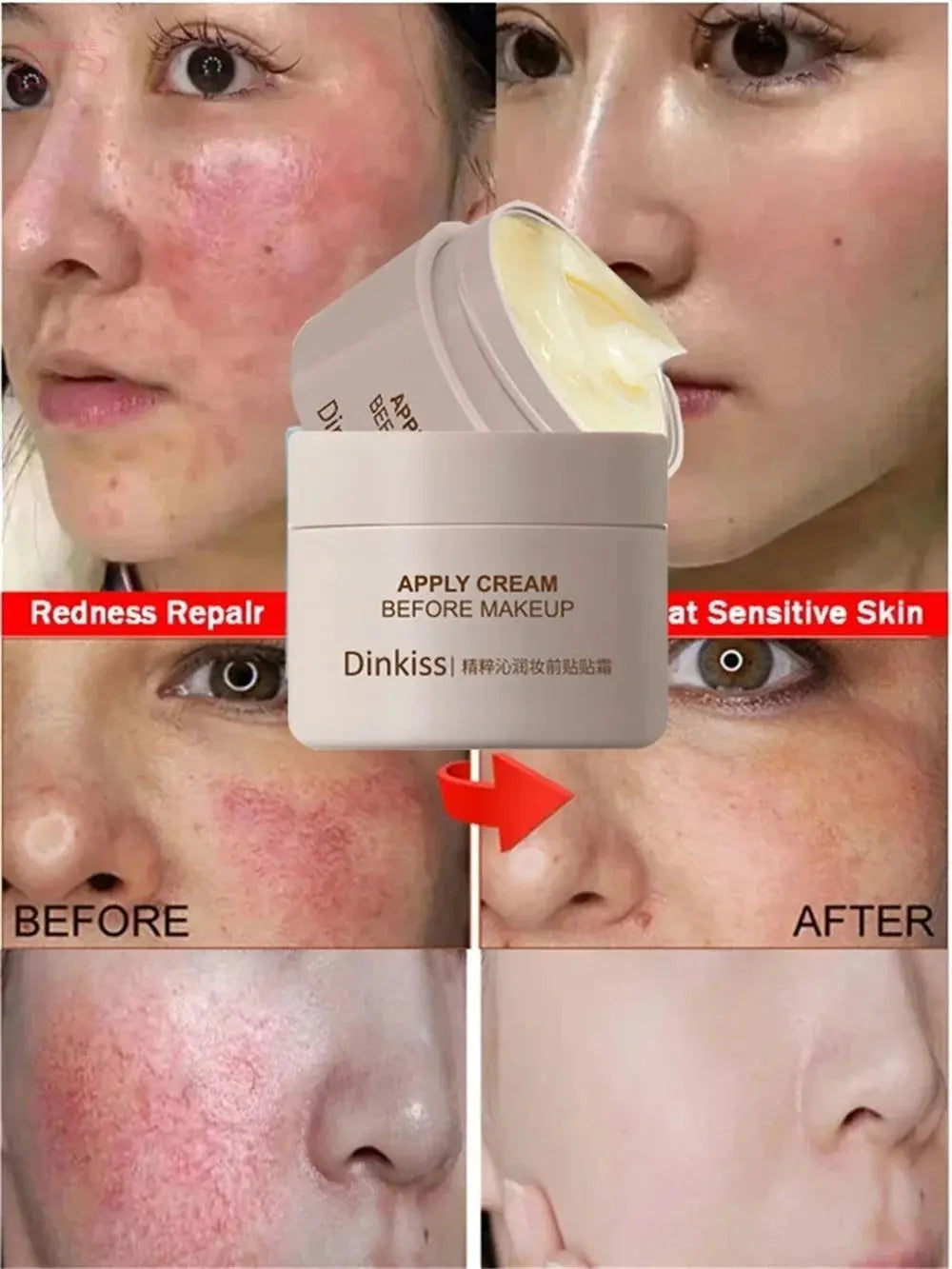 Facial Redness Repair Cream Improve Sensitive Skin Dryness Moisturizer Hydrating Sooth Lotion Removal Rosacea Korean Cosmetics - Brocelles