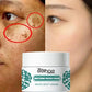 Niacinamide Melasma Brightening Cream Reduce Melanin Brighten Cream Lighten Dark Skin Chloasma Serum Weaken Fine Lines Face Care - Brocelles