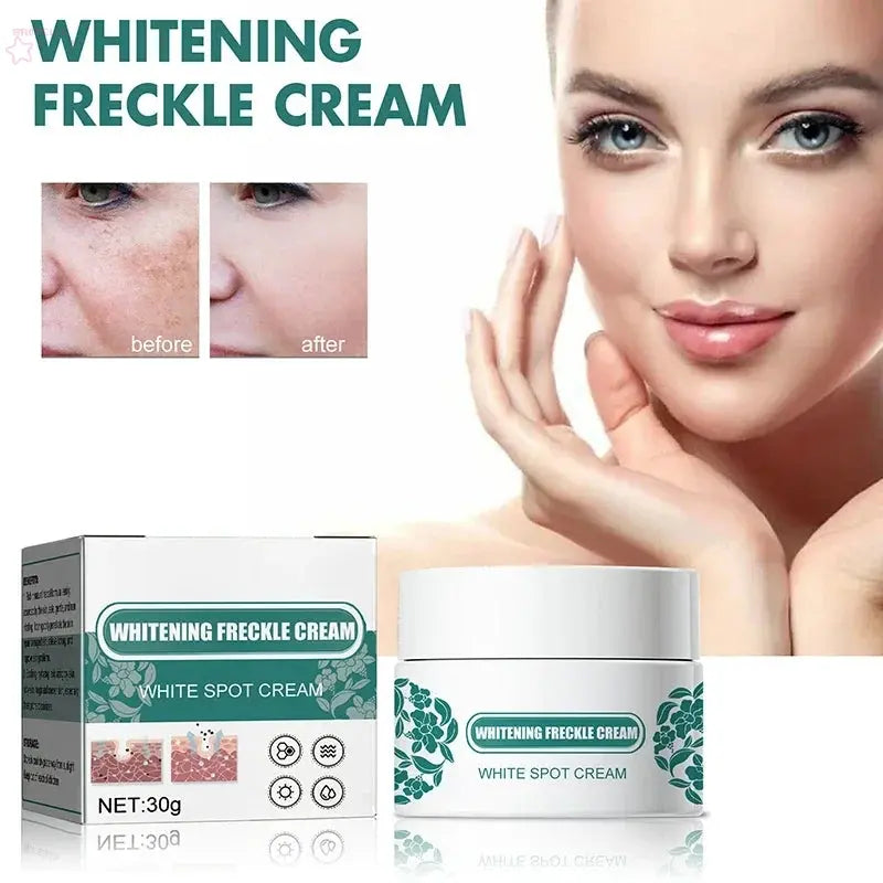 Niacinamide Melasma Brightening Cream Reduce Melanin Brighten Cream Lighten Dark Skin Chloasma Serum Weaken Fine Lines Face Care - Brocelles