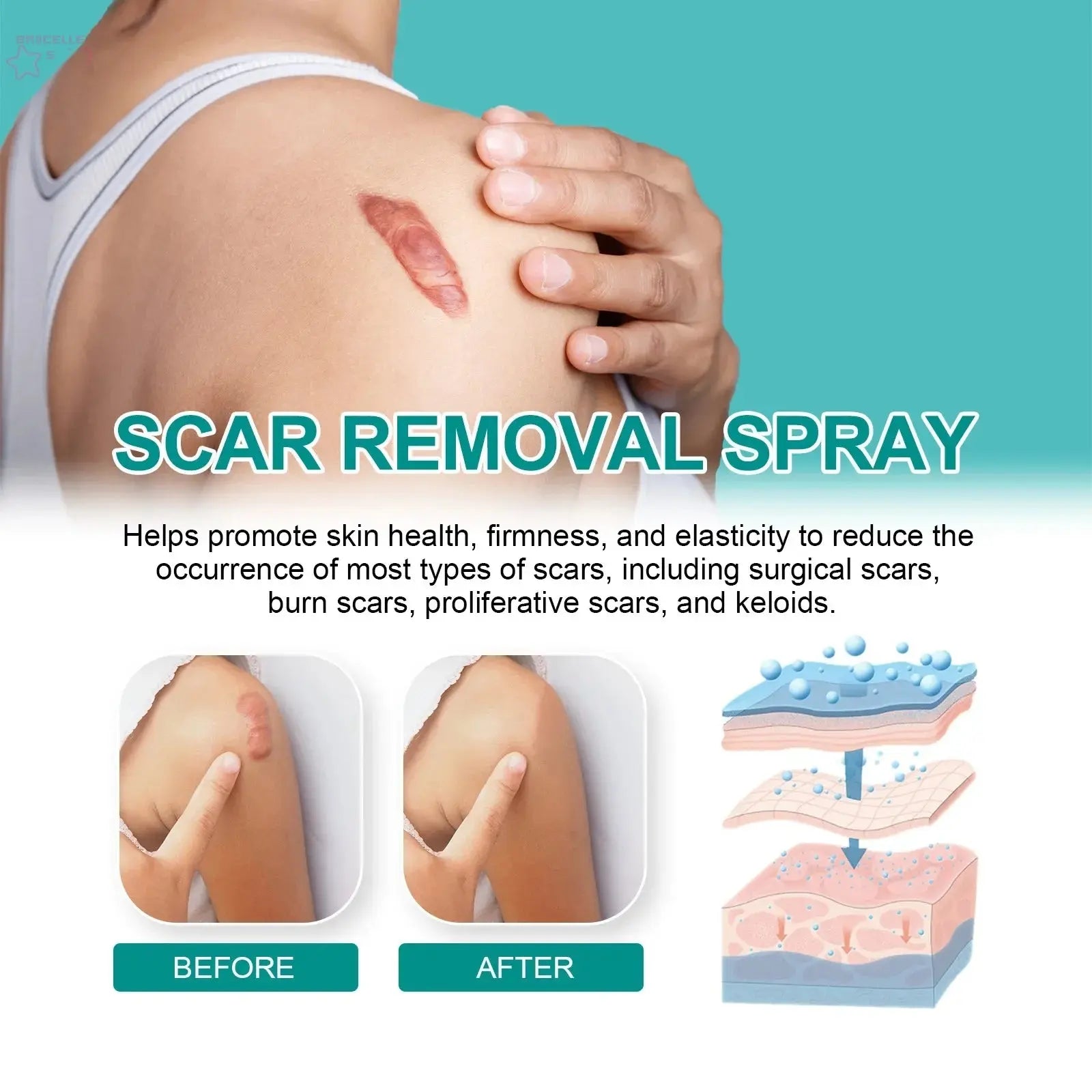 Scar Care Spray Fade Scars Pregnancy Smooth Skin Repair Spray Brocelles