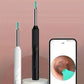 Smart Visual Ear Cleaner - Endoskop Wachsentfernungswerkzeug Ohrpick Mini-Kamera Gesundheitspflege-Set Brocelles