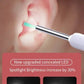 Smart Visual Ear Cleaner - Endoskop Wachsentfernungswerkzeug Ohrpick Mini-Kamera Gesundheitspflege-Set Brocelles