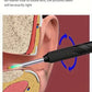 Smart Visual Ear Cleaner - Endoskop Wachsentfernungswerkzeug Ohrpick Mini-Kamera Gesundheitspflege-Set Brocelles