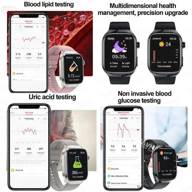 Xiaomi Uric Acid, Blood Fat & Health Monitoring Smartwatch Brocelles